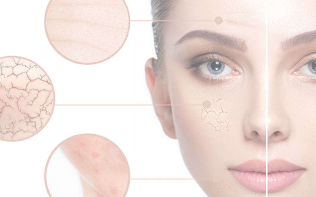 News 2025: Relilax® Haut-Check-up: Maßgeschneiderte Wellness für Ihre Haut
